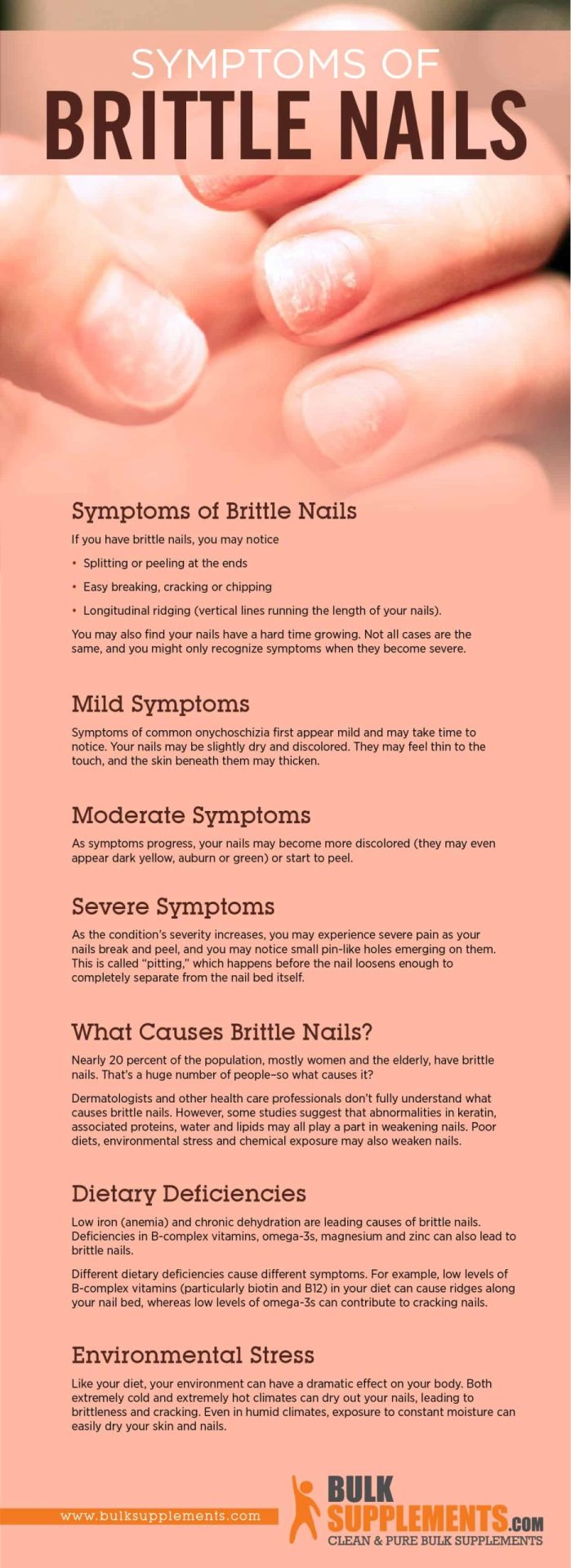 Brittle Nails in Dogs - A Common Issue with Many Causes - DogVills | Brittle  nails, Dog nails, Dog health tips
